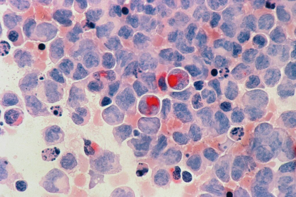 Natural algae robots could be used to treat bladder cancer